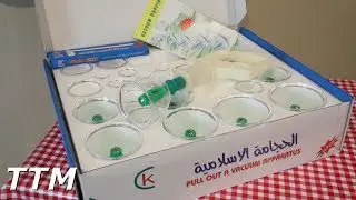 TRTMED Vacuum Cupping Set Review