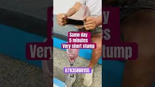 Best Artificial Leg In Delhi | Same day Fitment | Artificial Leg For Running | Nakli Pair Ka Price