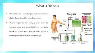 What is hemodialysis-faswal pichan
