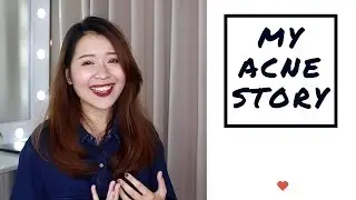 C&Acirc;U CHUYỆN DA MỤN + TIPS | Letsplaymakeup