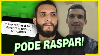 Posso raspar a barba durante o tratamento com Minoxidil? (respondendo perguntas)