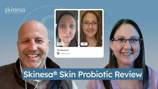 Skinesa® Customer Interview | Christina’s Experience