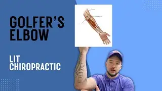 Golfer's Elbow Care | Fremont CA Chiropractor | Bay Area, CA