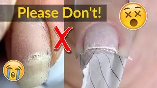 Nail Form Fitting Mistakes