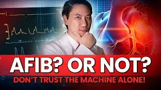 Irregular Pulse Alert: How to Know If It&rsquo;s AFib or Just Normal Rhythm