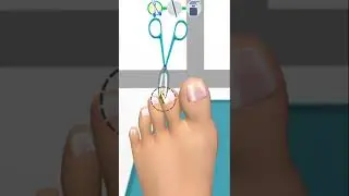 Foot Clinic Asmr Feet Care Game // Mobil Game // #shorts