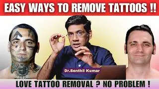 Regret having tattoos ? Want it removed ? These are the things you should know !! | Creas Cosmetic