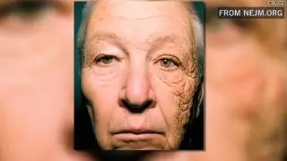 Chilling photo shows the effects of sun damage