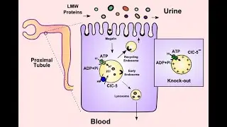 Dent disease (genetic kidney disorder) ; Causes, symptoms, Diagnosis, Treatment