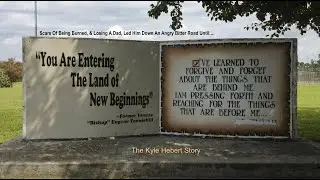 Land Of New Beginnings: Scars Of Being Burned, & Losing A Dad Led Him Down A Bitter Road Of Anger
