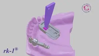 rk-1 Uni C Plus Resilient Attachment