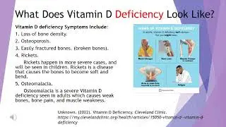 Vitamin D  ESavage MZuniga 1