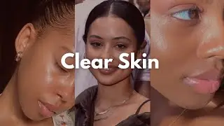 How To Get Clear Skin 