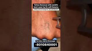 Permanent Tattoo Removal | Dr.Lalit Kasana Clinic ll Before and After Results