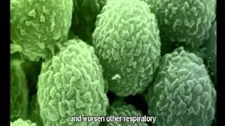 Triggers   Mould