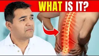 Why Back Pain is Misdiagnosed Nearly Every Time