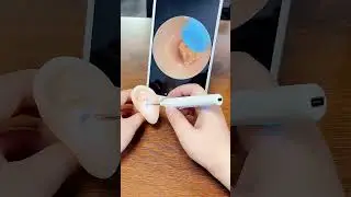 Relaxing Ear Cleaning ASMR Videos #relax #earwax #acne #satisfy
