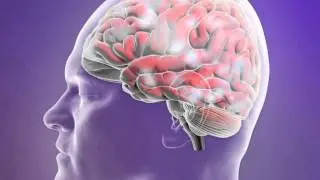 E-Action Info - Absence Seizure