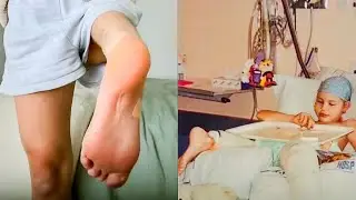 My Backwards Foot Saved My Life