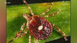 Lone Star ticks cause red-meat allergies, moving to northern U.S.
