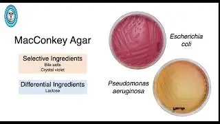 Selective Vs Differential Media(Medical Microbiology):@medicallab9517
