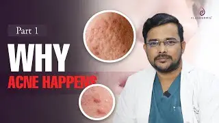 Acne: The Real Reason You Break Out | allodermis | Dr Alok Sahoo