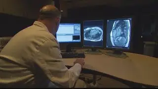 How does COVID-19 affect the heart?