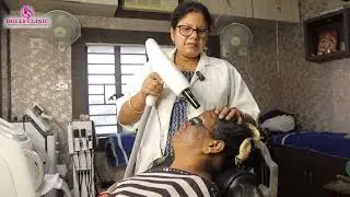 IPL Treatment // Carbon Laser Treatment #glowingskin #pigmentation #ipl