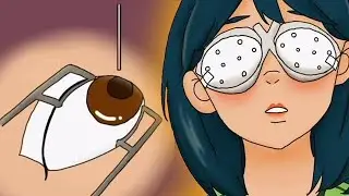 No Creerás lo que Hice Para Poder Usar Lentes