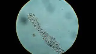 Aeolosoma