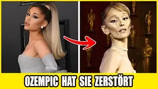35 Stars, Deren Gesichter Durch „Ozempic“ Zerstört Wurden – Vorher & Nachher, Das Jeden Schockiert!