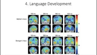 13.4. Language Brain Development, Fundamentals of Cognitive Neuroscience Course, Session 13, Part 4