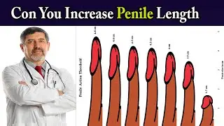 How To Increase Your Penis* Size ( Penile Size Myths &Facts )