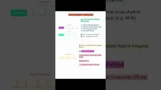 General Surgery ECG Series #Irregular rhythm#heart rate#shortsfeed #medicalstudent #tips