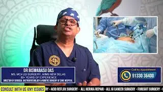 DON'T MISS THIS VIDEO IF YOU HAVE GALL STONES | Dr. BB Das, India's #1 Robotic GI Surgeon