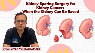 Kidney Cancer: Can the Kidney Be Saved? Understanding Partial Nephrectomy | Dr Vivek Venkatramani