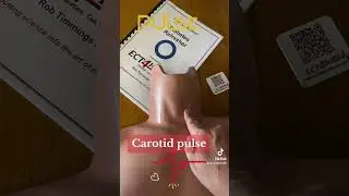 Carotid pulse