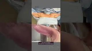 Arm Lift &mdash; 7 Weeks Post Op 💪🏽