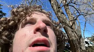 Dumb Guy Looks at Eclipse Without Glasses