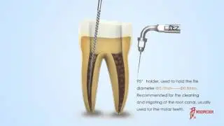 Woodpecker TIPS E2