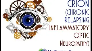 Optic Neuritis Chronic Relapsing Inflammatory Optic Neuropathy