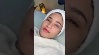 BB Glowing | Before/After  #skincare #zenabeauty