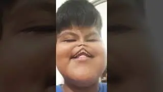 a mi prima le pic&oacute; muy feo el chile y se pic&oacute; la lengua y se muri&oacute;