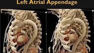 Cinematic Rendering in the Heart