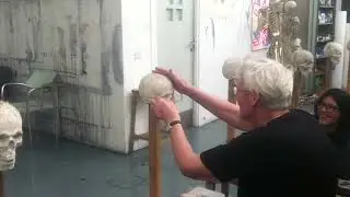 Richard Kneave facial reconstruction