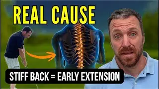 I Can't Fix My Early Extension Until I Fix My Body