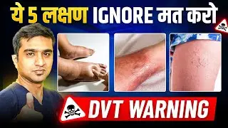 Leg Pain & Swelling? | Early Warning Signs of Deep Vein Thrombosis | Dr. Ashank Bansal