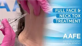 Full Face & Neck Tox Treatment