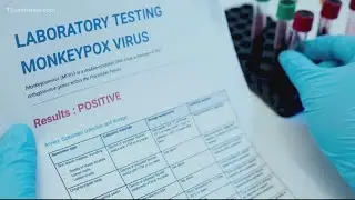 VDH tracks the latest monkeypox case count in Virginia