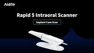 Rapid 5｜Implant Case Scan